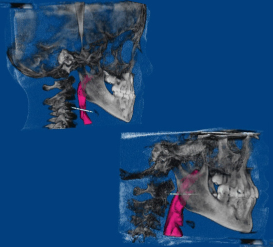 airway centered orthodontics